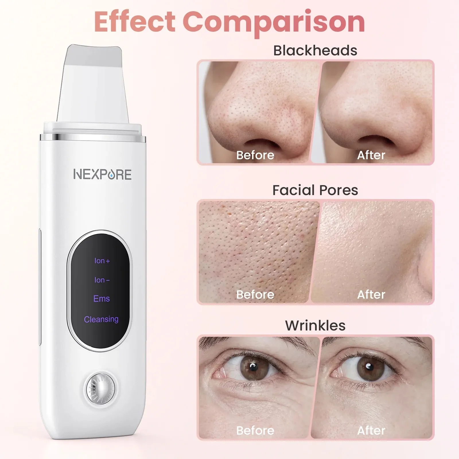 NEXPURE Skin Spatula - 4 Modes, Blackhead Remover, Pore Extractor, Deep Cleansing for Facial Skin Care, White